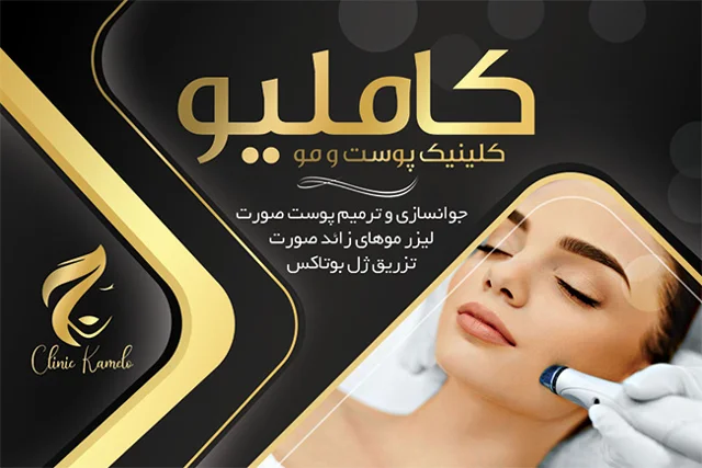 لیبل سلفون مات